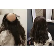 Hair Replacement Singapore logo